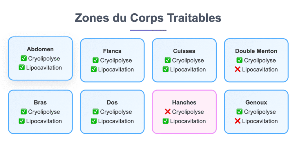 zones du corps traitables comparaison Cryolipolyse et lipocavitation